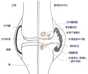 犬骨關(guān)節(jié)病