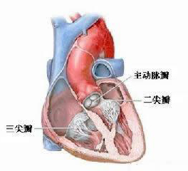主動脈瓣狹窄
